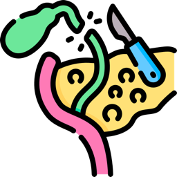 Gallbladder and bile duct illustration with a scalpel poised to cut