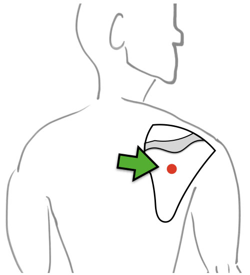 Small Intestine Channel | TCMStudy.net